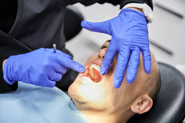 Best Chipped Tooth Repair Near Me  in Sheridan, OR